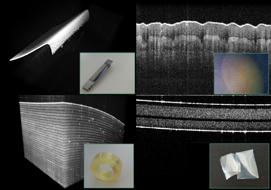 Optische Kohärenztomographie