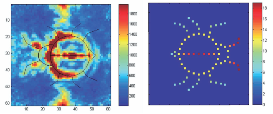 Ultraschall-Rohdaten mittels Matrix-Array