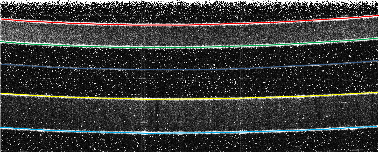 2D-Schnittbild einer Mehrfachfolie mit detektierten Kanten (farblich dargestellt)