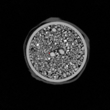 Schicht einer Standard 3D-Computertomographie