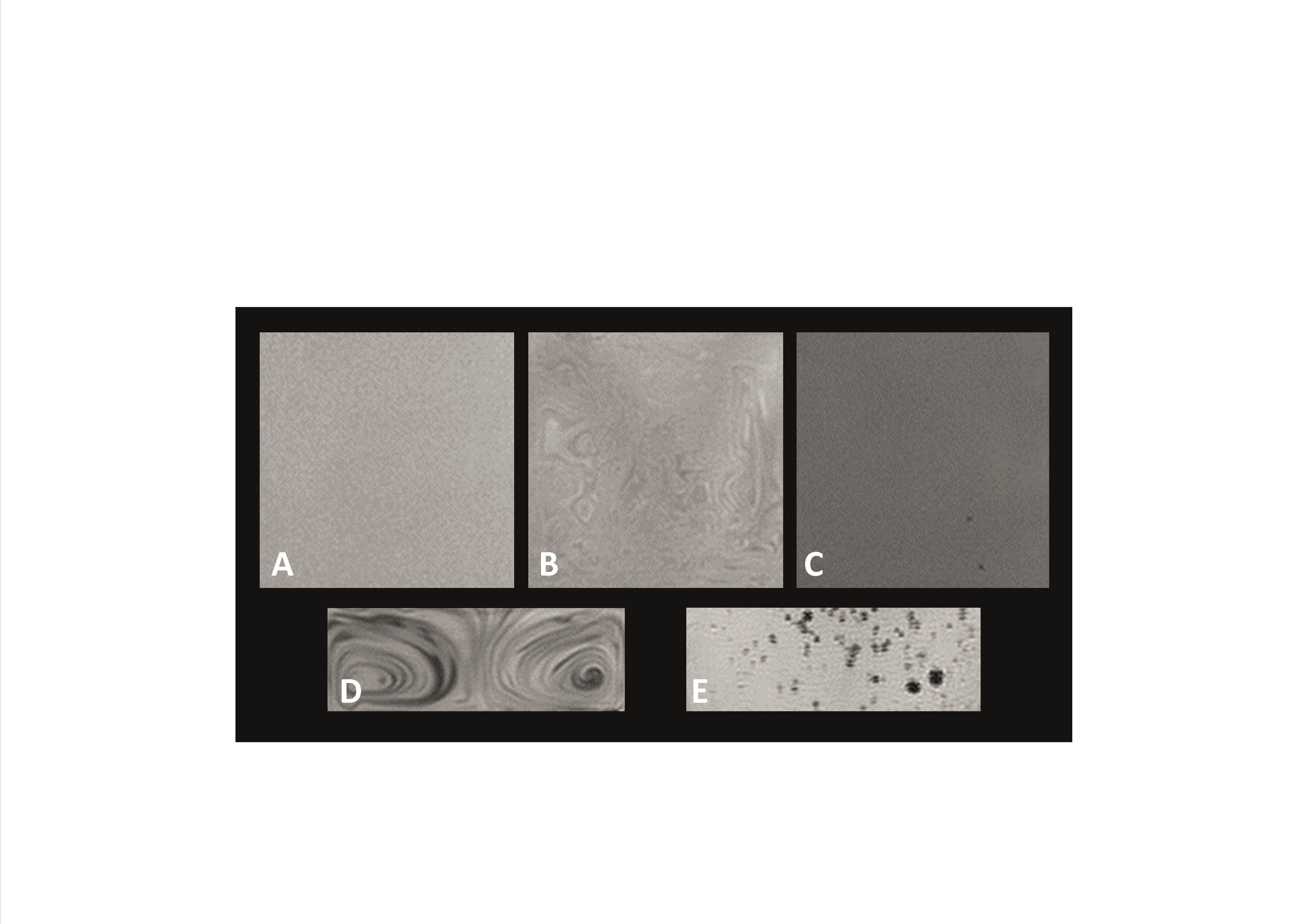 Magnetic resonance tomogram of a silicone sample